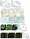 Podocyte density, scarring, stress, and ultrastructure.