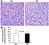 Analysis of tumor angiogenesis in EP2–/– and wild-type animals. (a) Stainin