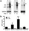 mRNA and protein expression of sFlt1 in preeclampsia. (a) mRNA expression o