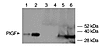 Western blot analysis for PlGF expression in pregnant rats versus nonpregna