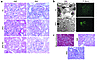 sFlt1 induces glomerular endotheliosis. (a) Histopathological analysis of r