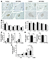 Normal expression of Pdx1, normal insulin contents and increased insulin se