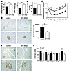 βHT-IRS2 mice on a high-fat diet for 4 weeks, starting from 4 weeks of age.