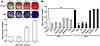 Production of ROS in 3T3-L1 adipocytes. (A) ROS production during different