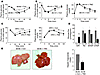 Effects of expression of the MCP-1 mutant 7ND on insulin sensitivity in obe