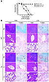 Tie-Tg mice exhibit increased sensitivity to LPS-induced toxemia.