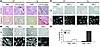 Transgenic ECs exhibit enhanced apoptosis.