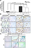 Enhanced tumorigenesis in Tie-Tg mice is endothelial cell intrinsic.