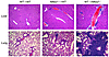 Autoimmunity in Nfkb2–/– mice resulted from stroma defect.