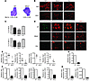 Thymic defect of reduced expression of Aire and other TSA genes in Nfkb2–/–