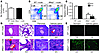 Nfkb2–/– thymic stroma are sufficient to induce autoimmunity in thymi-graft