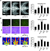 Ephrin-B2–Fc increases EPC proangiogenic potential in hind limb ischemia.