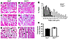 IKK2 depletion promotes muscle regeneration.