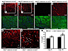 IKK2 muscle deletion increases multinucleate regenerating fibers.