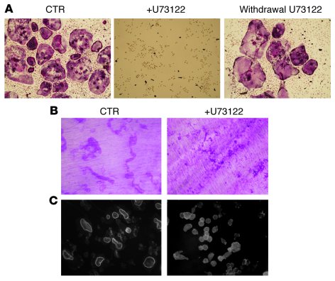 PLCγ inhibition blocks osteoclastogenesis and actin ring formation.
(A) ...