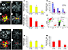 BM subpopulations accelerate retinal revascularization and reduce preretina