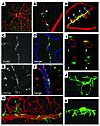 Intravitreally injected CD44hi cells take on characteristics of retinal mic