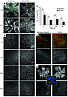 Microglia participate in retinal vascularization.