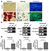 Mesenchymal cells isolated from BAL fluid of lung transplant recipients dif