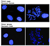 MSCs isolated from BAL fluid of transplanted lungs are of donor sex genotyp