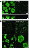 Ga prevents P. aeruginosa biofilm formation.