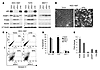 Endogenous p63 is required for survival in breast cancer cells.