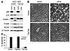 Survival of breast cancer cells is promoted by p63 through repression of TA