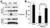 TAp73 phosphorylation at Y99 is required for cisplatin-induced ΔNp63α/TAp73