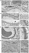 Transmission electron microscopy of mouse kidneys.