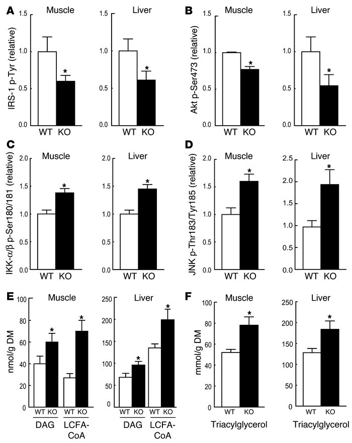 Macrophage-specific PPARγ gene deletion causes impaired insulin signalin...