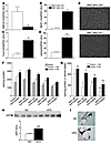 Loss of PPARγ causes macrophage activation and secretion of insulin resista