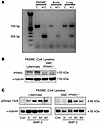 Mice with targeted deletion of PPARγ in SMCs maintain BMP-2–induced pSmad1/