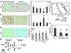 Intratumoral anti-CD40/IL-2 treatment reduces tumor vascularity.