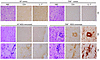 Increased CNS inflammation in TRIF-deficient mice during EAE.