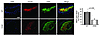 Accumulation of the endothelial-specific antigen CD105 is diminished in car