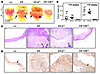 Complete abrogation of gastric tumor formation in gp130Y757F/Y757F mice lac