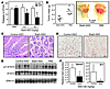 Reduced STAT3 activation and gastric tumor burden in STAT3-ASO–treated gp13