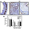 STAT3-dependent gastric tumorigenesis is independent of hematopoietic syste