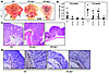 Loss of STAT1 or STAT3 alleles in gp130Y757F/Y757F mice alleviates gastric