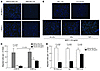 Murine and human macrophage migration in vitro is inhibited by NO2LDL in a