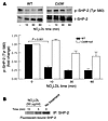 Inactivation of SHP-2 by NO2LDL.