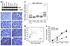 AEG1 is overexpressed in HCC cells and HCC tumor samples, and AEG1 inhibiti