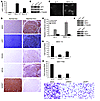 LEF1 plays a role in mediating AEG1 function.