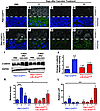 Regeneration-associated reactivation of β-catenin signaling is inhibited du