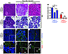 β-catenin is required for efficient acinar regeneration.