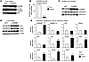 Overexpression of ChREBP in livers of mice leads to the induction of the en