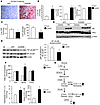 Overexpression of ChREBP leads to modification in hepatic lipid composition