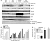 ChREBP overexpression protects against PALM-induced insulin resistance in p