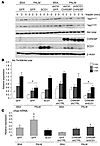 In vitro overexpression of SCD1 recapitulates the beneficial effect of ChRE