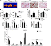 Exacerbated steatosis in HFD-fed ChREBP mice.